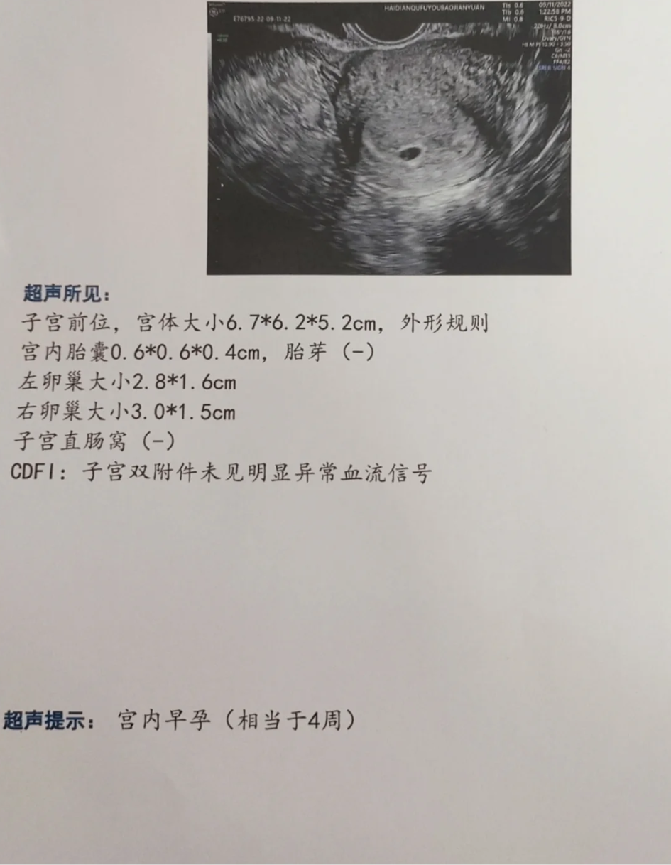孕4周做b超通常还看不到宫腔里的妊娠囊