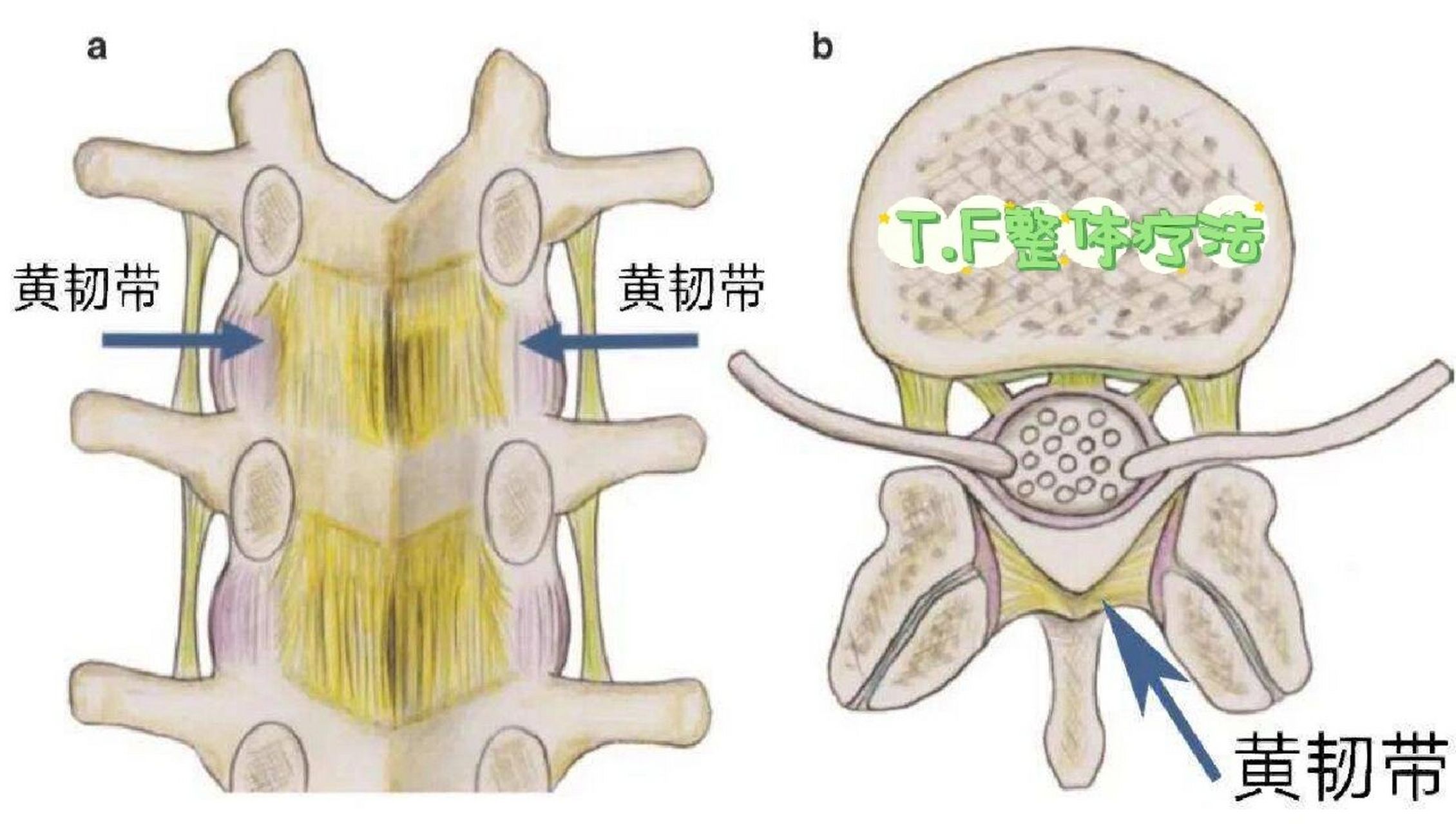 椎板间隙图片