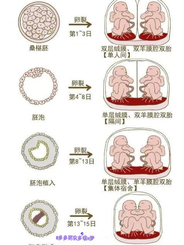 双子宫图片 怀孕图片