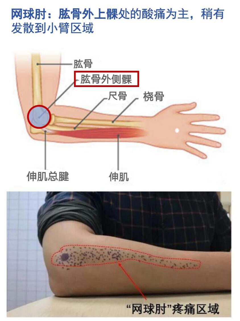 手臂部位图解 叫法图片