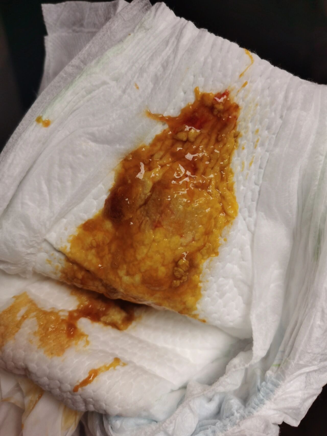 牛奶蛋白过敏1 摆脱焦虑(附便便图) 说说我家宝,出生到现在5个月,都是