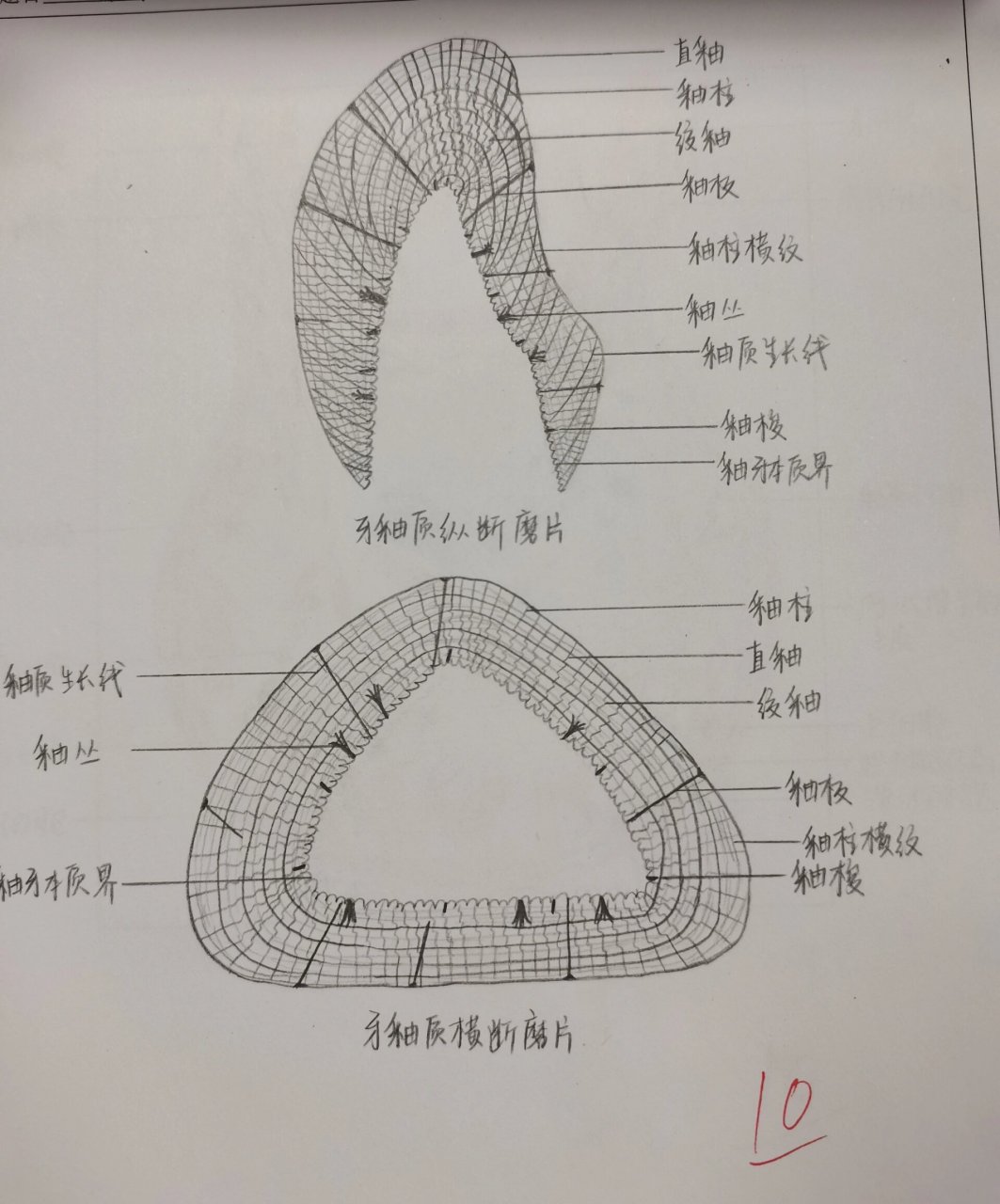 红蓝铅笔绘图 钟状期牙胚 牙釉质纵横断面磨片 根尖肉芽肿 寻常型天