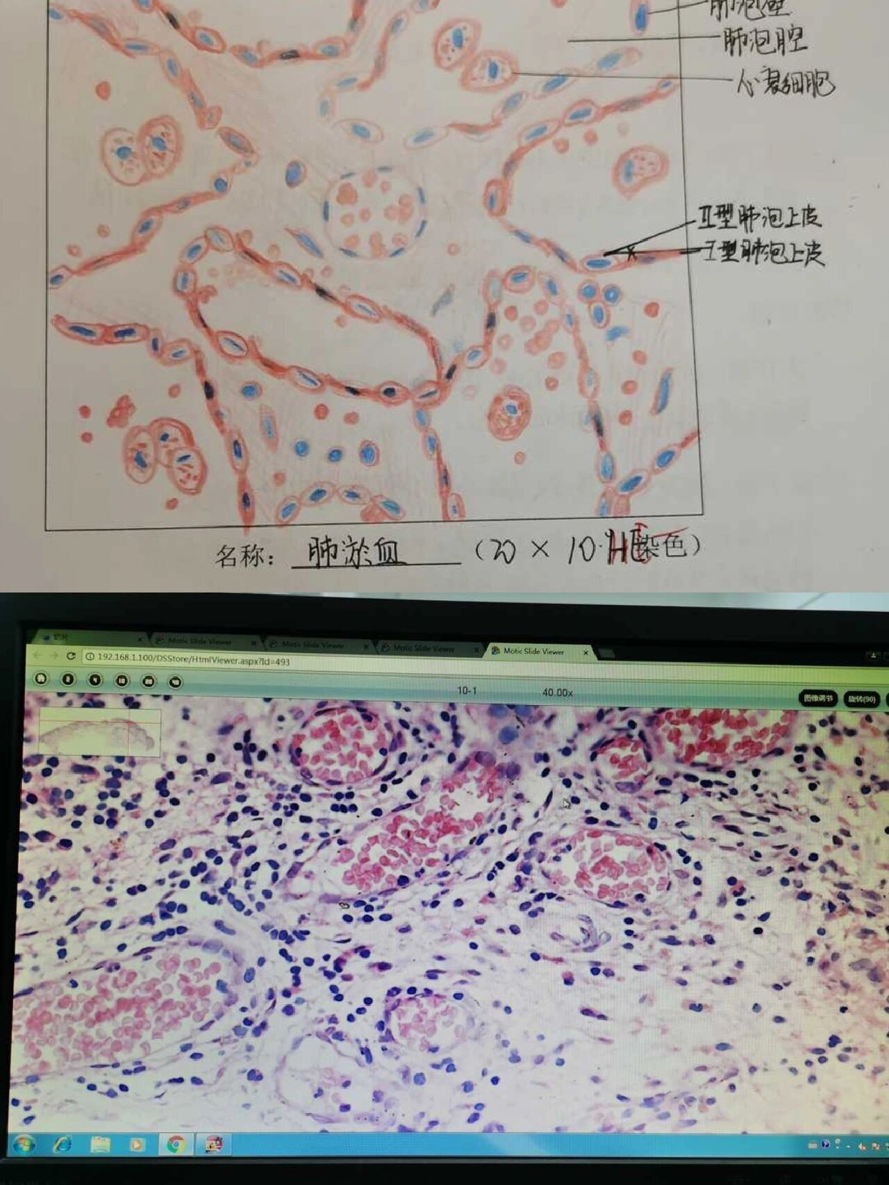 假小叶红蓝铅笔图图片