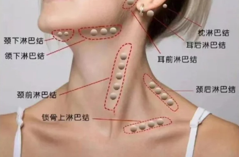 正常情况下,颈部淋巴结很小,直径一般小于0.5cm,摸起来光