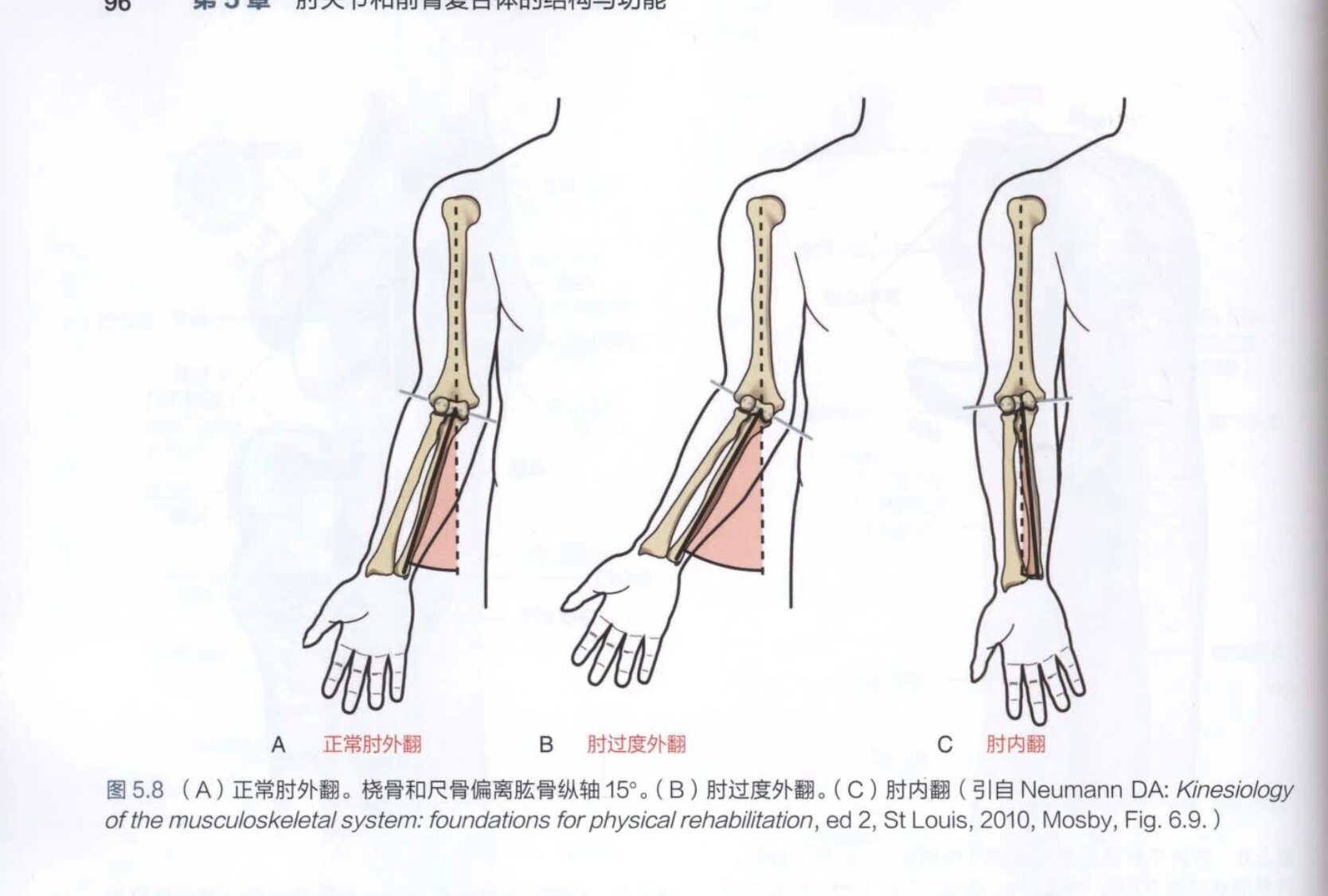 肘外翻15度图片图片