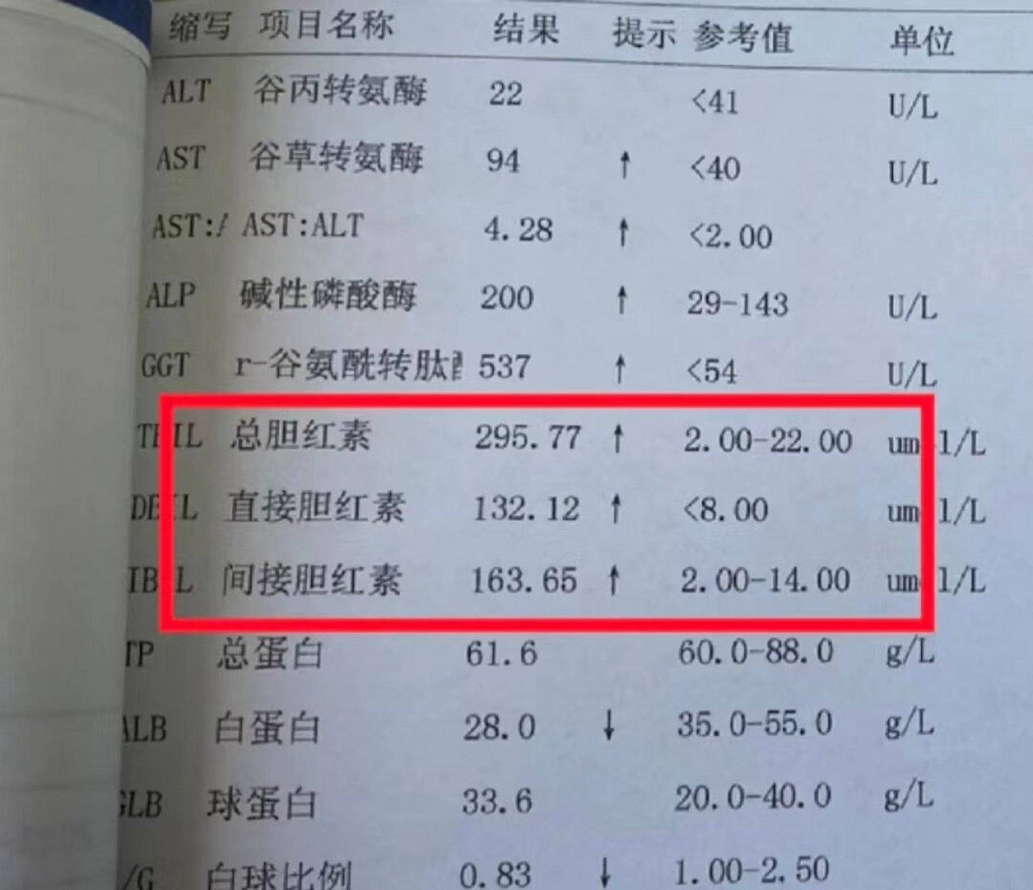 胆红素是肝功能检查的一个重要指标,相信很多人都做过!