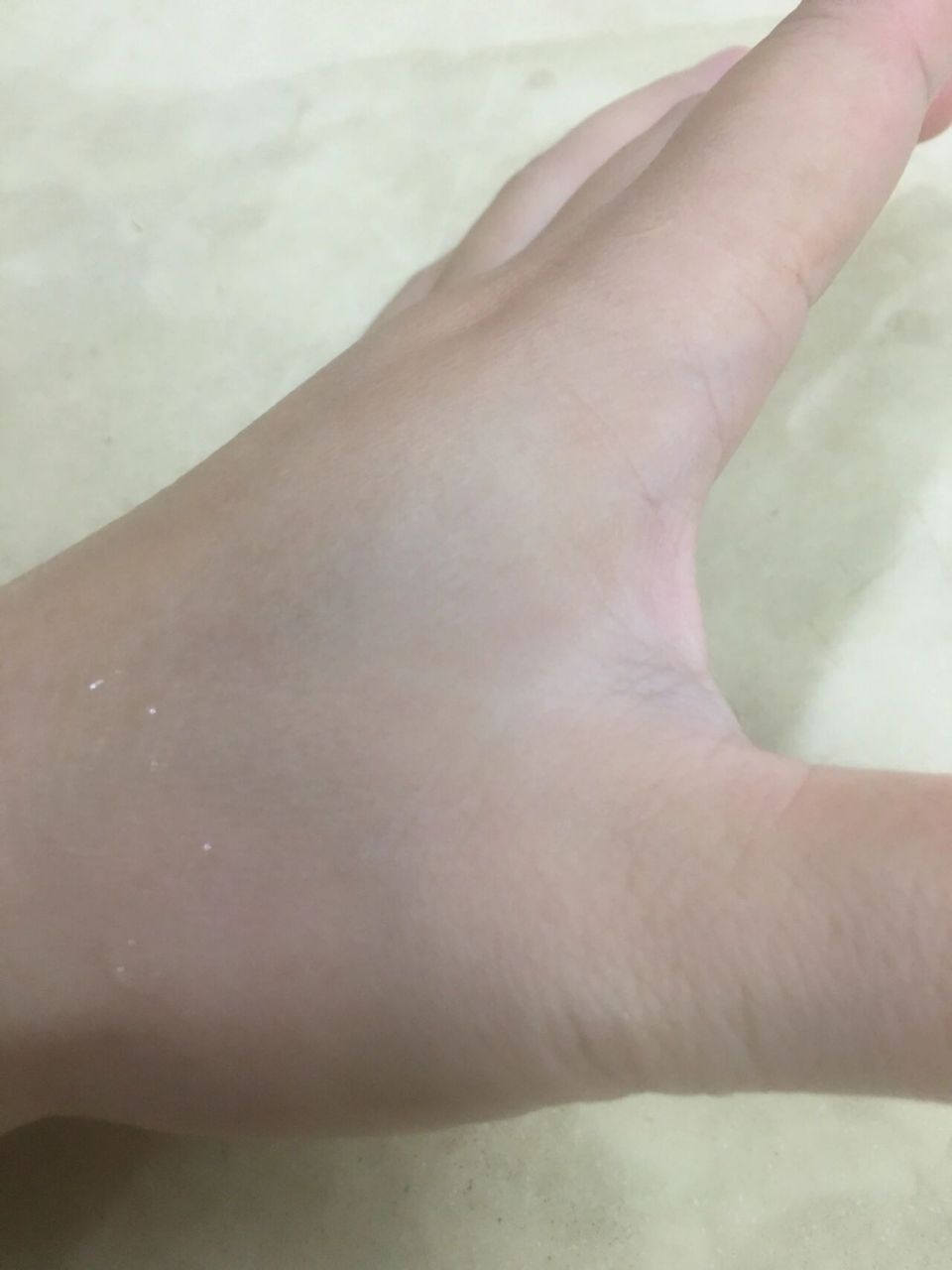 虎口都肿了,经常性虎口酸痛,真难