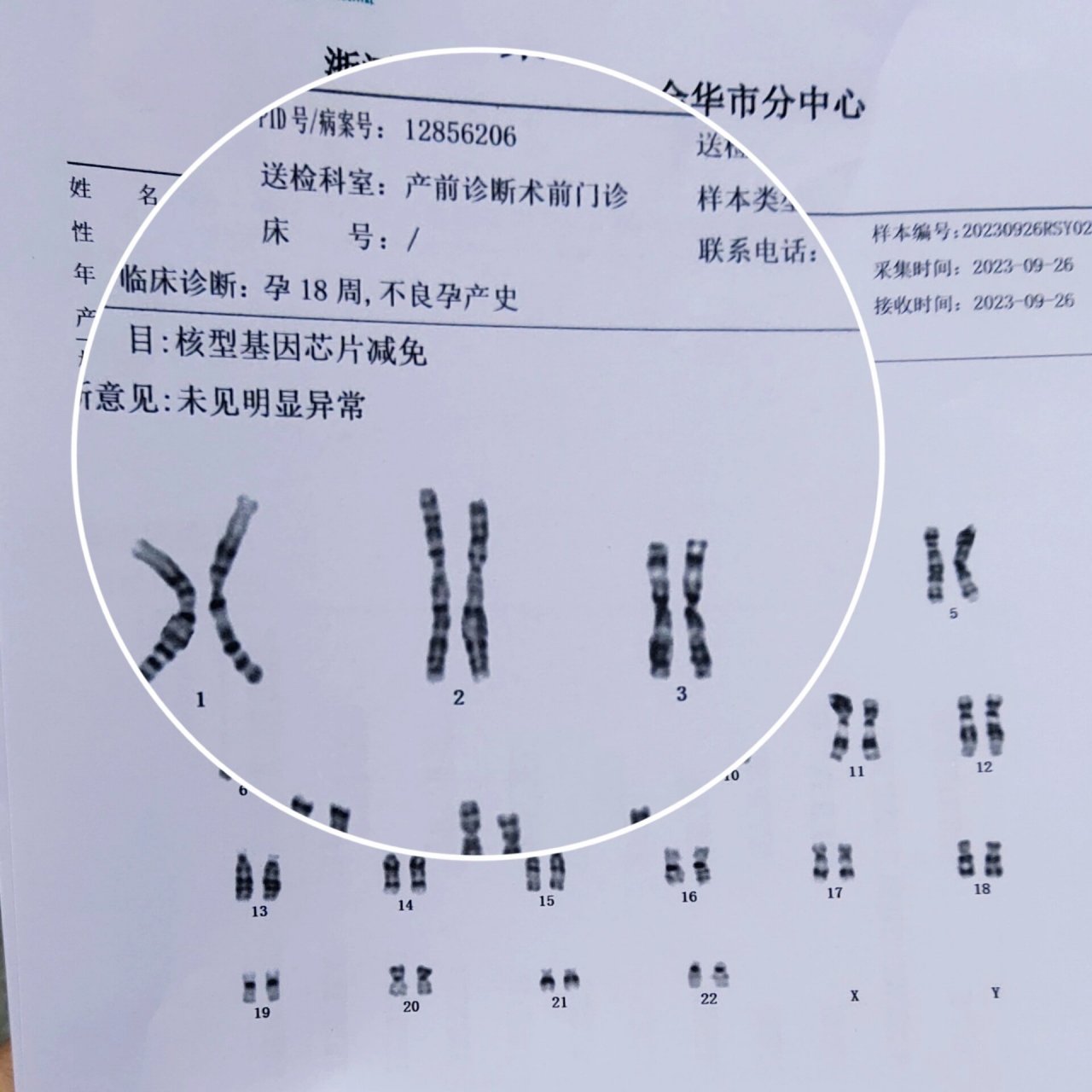 女性染色体报告图片