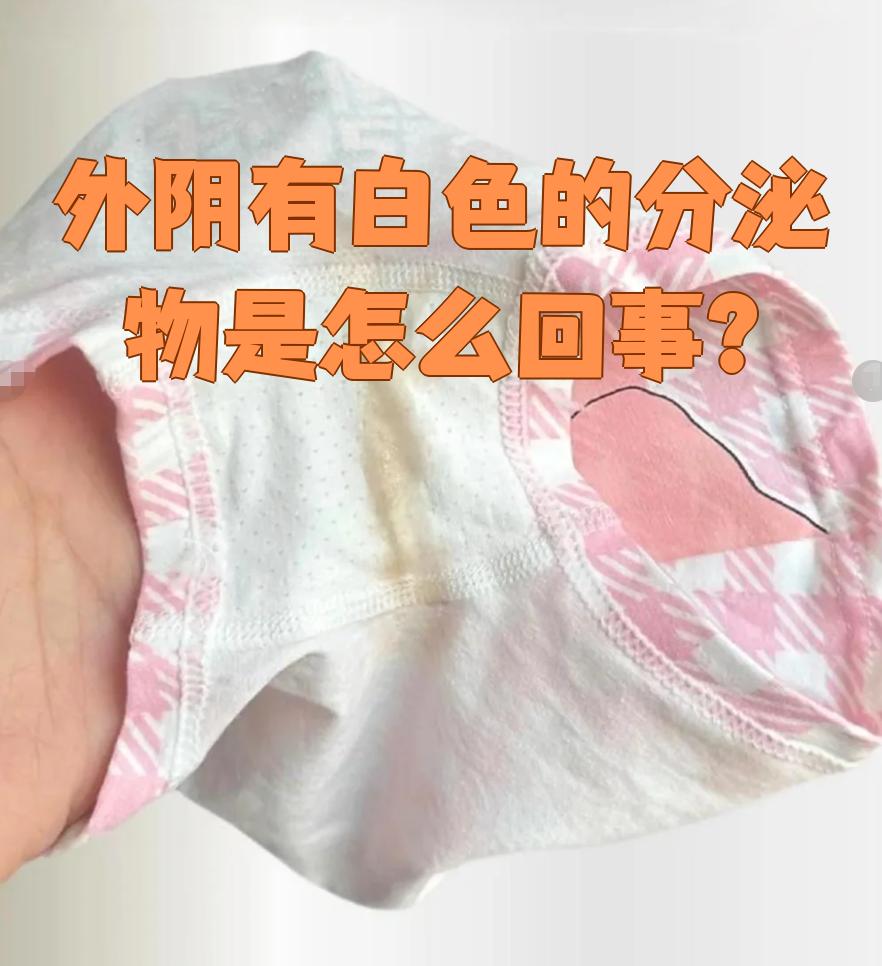 如果是生理性现象,白带通常是蛋清样的,但会随着月经周期变化