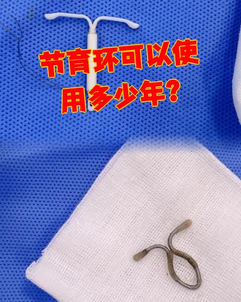 节育环能用多少年要看具体材质,不同材质的有效期从5年到20年不等