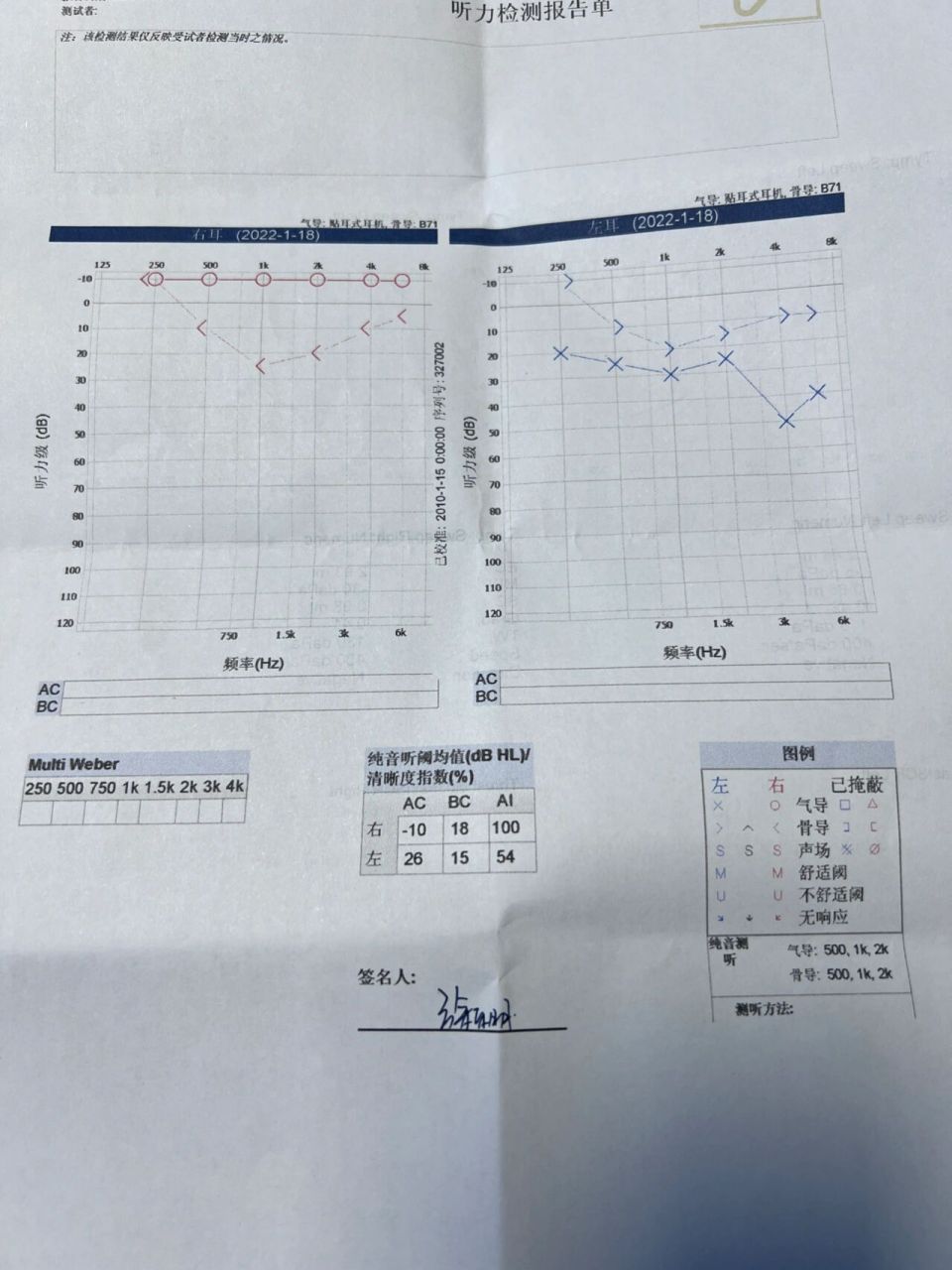 耳鸣一周去检查发现是耳屎堵住了