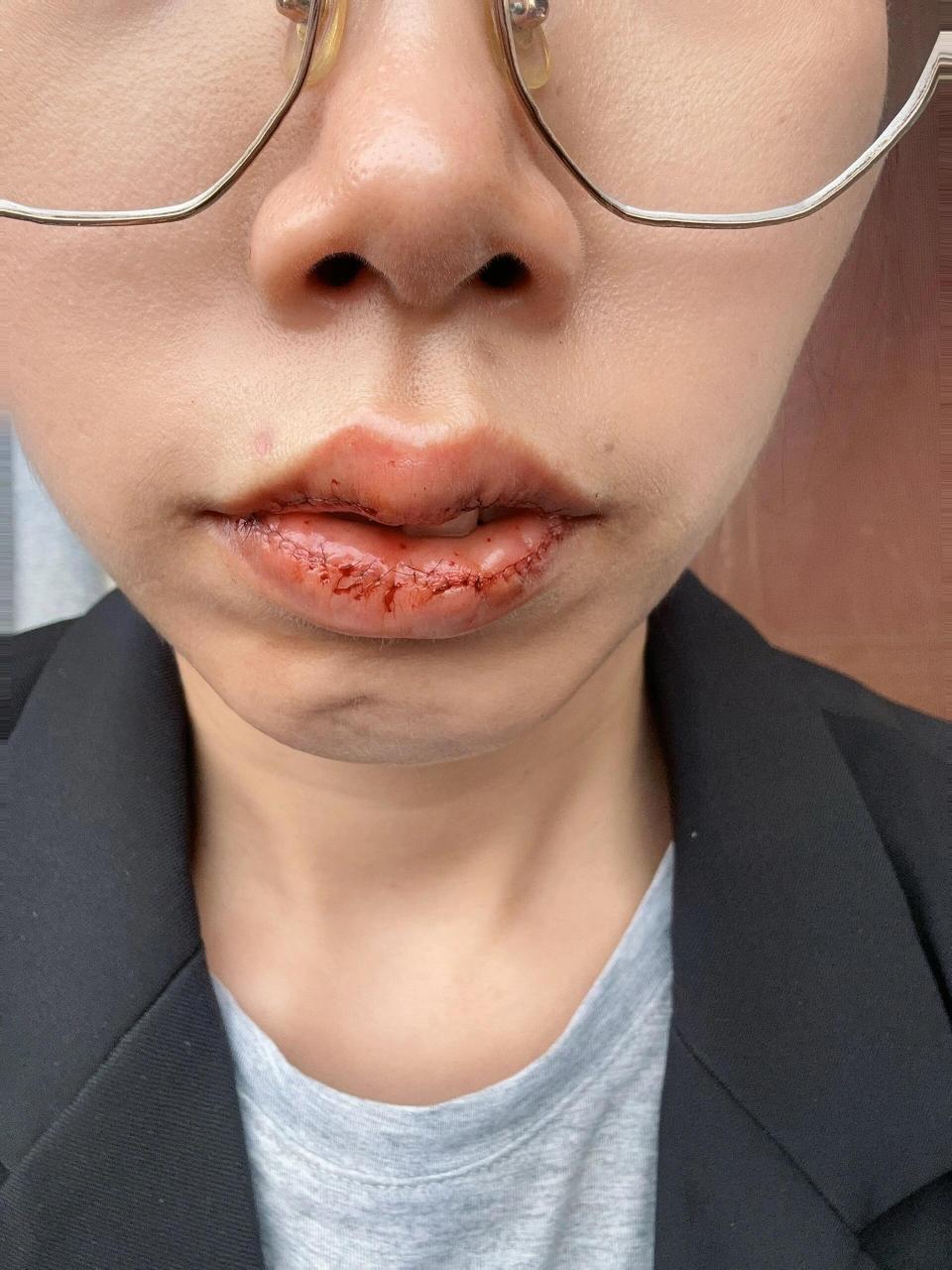 m唇图一是做之前,后面是刚刚做好的,嘴巴闭