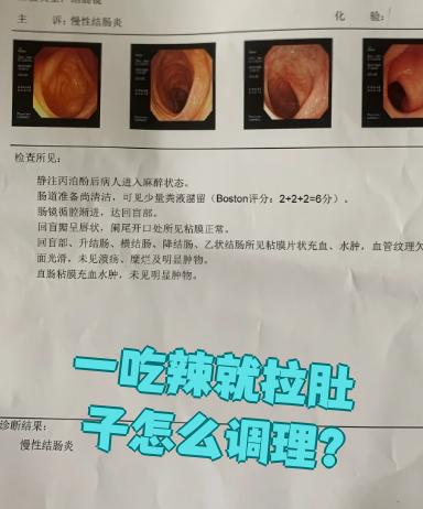 为什么一吃辣的就拉肚子 为什么一吃辣的就拉肚子