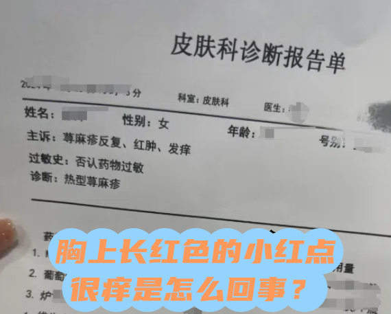 女性胸痒是因为什么原因百科在线