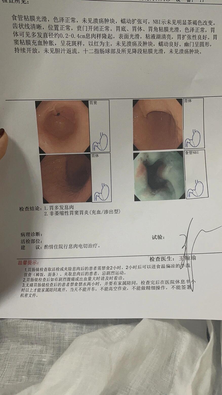 求助,我的胃严不严重 21年有过一次胃息肉冷切手术