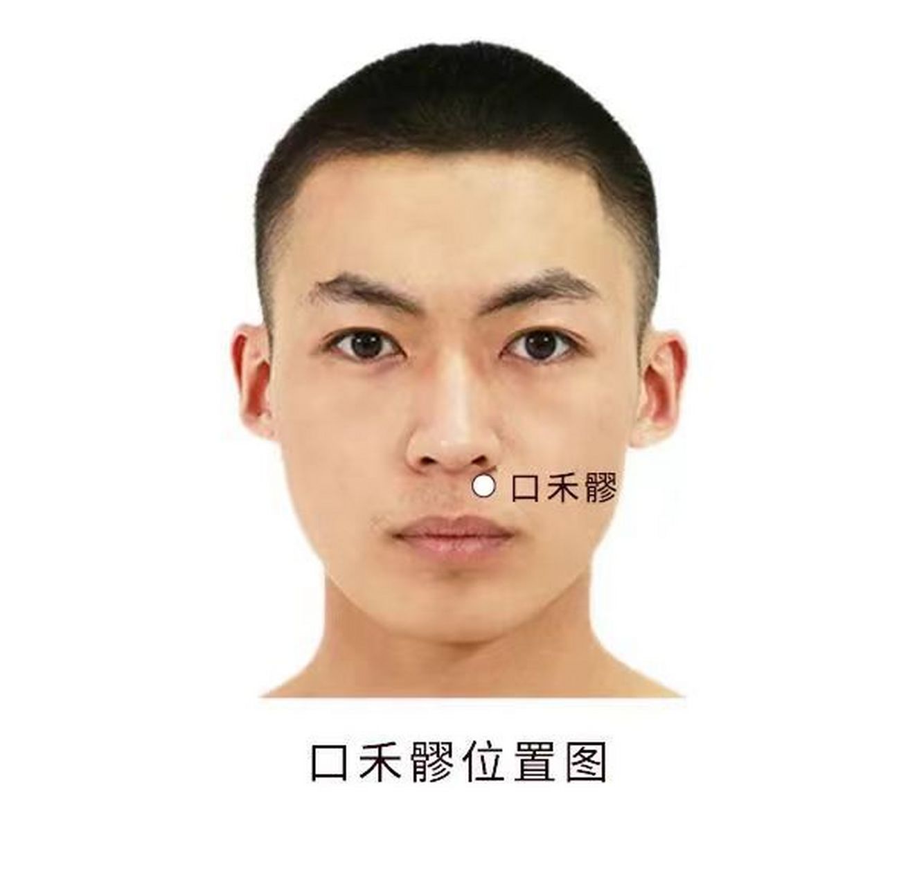 口禾髎穴-——祛风清热开鼻窍 口禾髎穴-——祛风清热开鼻窍 【穴位