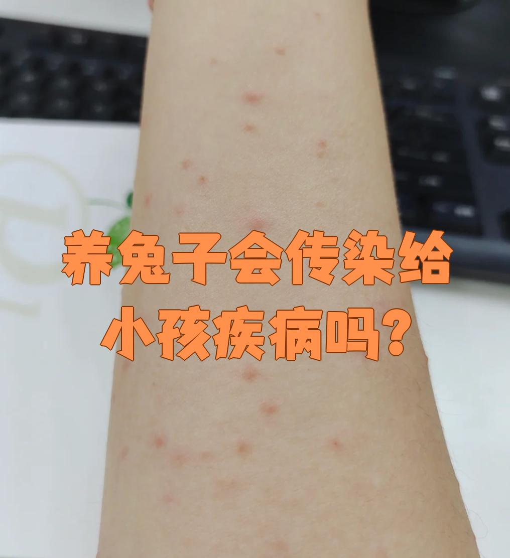 另外,兔毛容易掉,可能引发哮喘等呼吸道问题