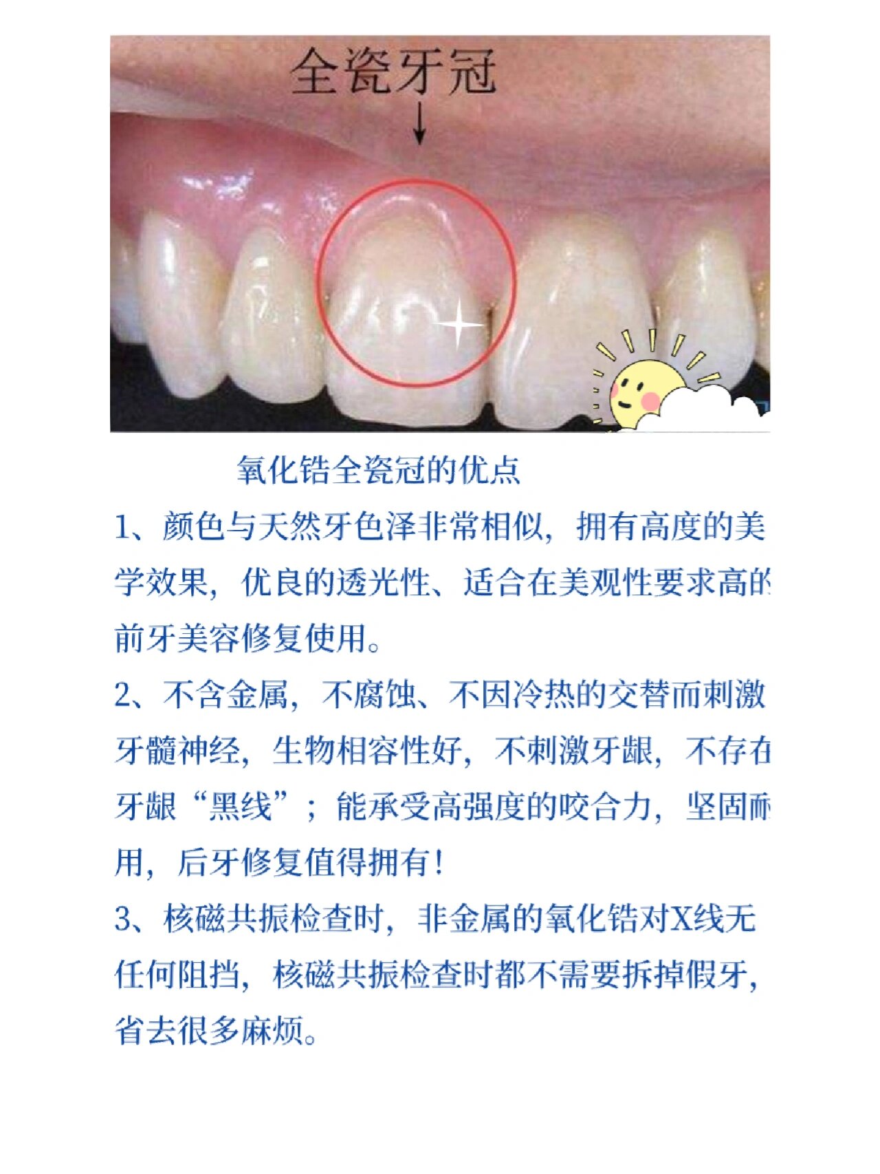 烤瓷冠失败图片