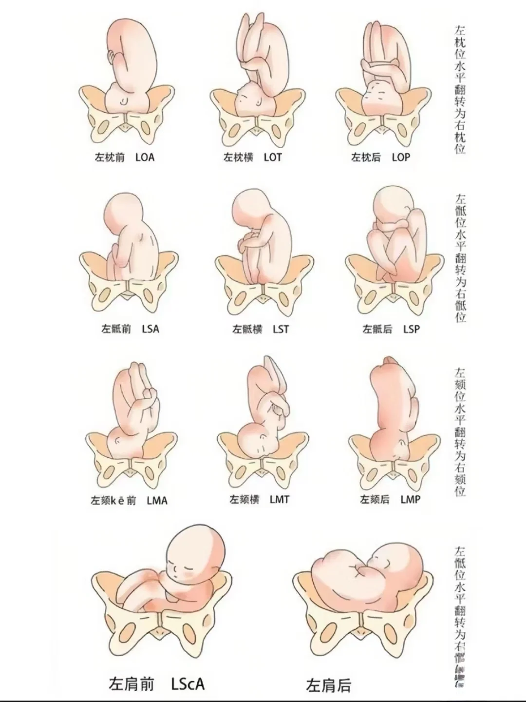 臀位胎心位置图片