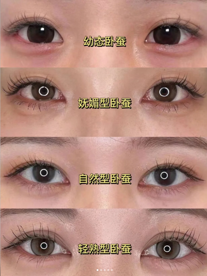 为什么不建议打卧蚕呢熊猫针怎么取出为什么在线