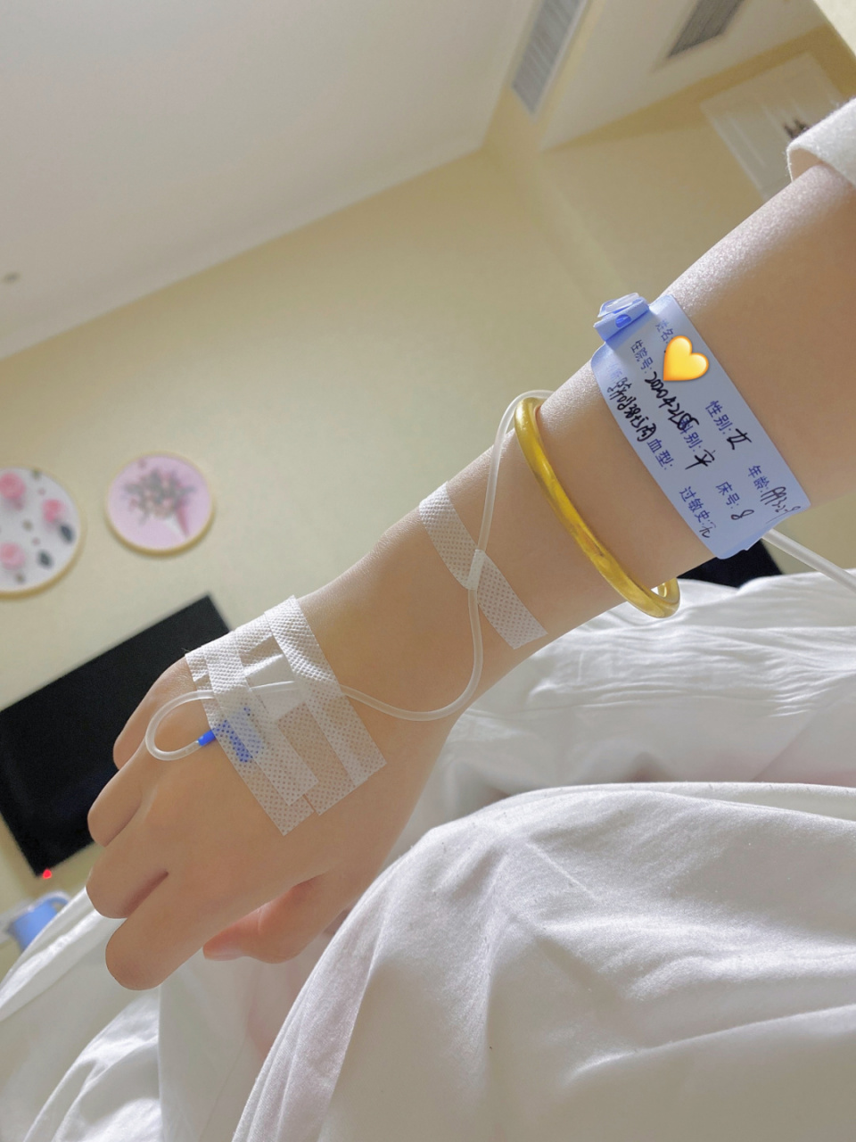 凌晨1点破水了 马上赶来医院 现在等待打催产针 最贵手环已经戴上啦