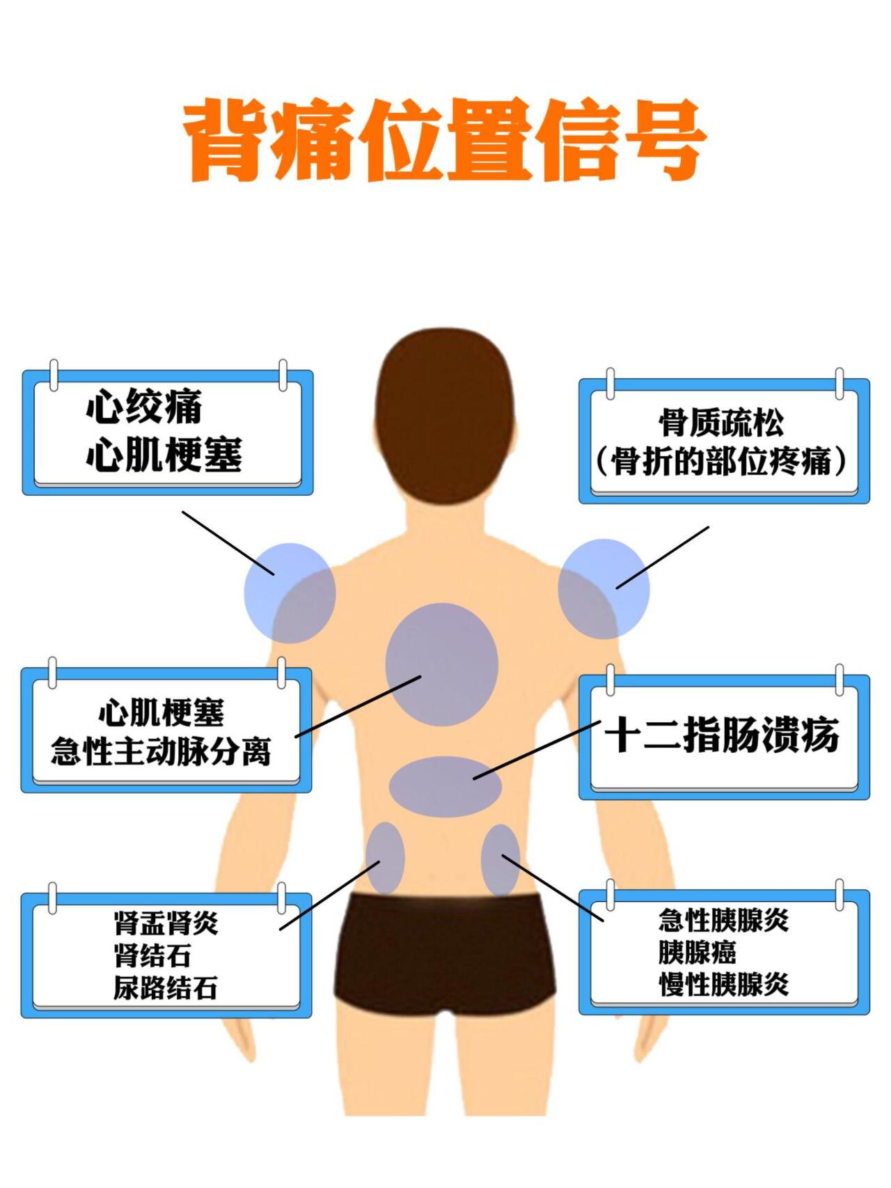 后背部位疼痛图解图片