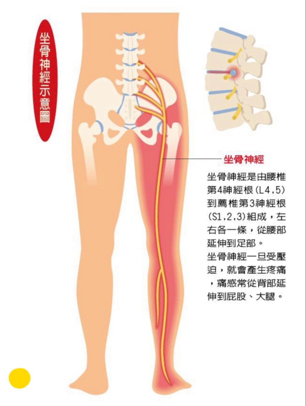 坐骨在哪里位置图图片