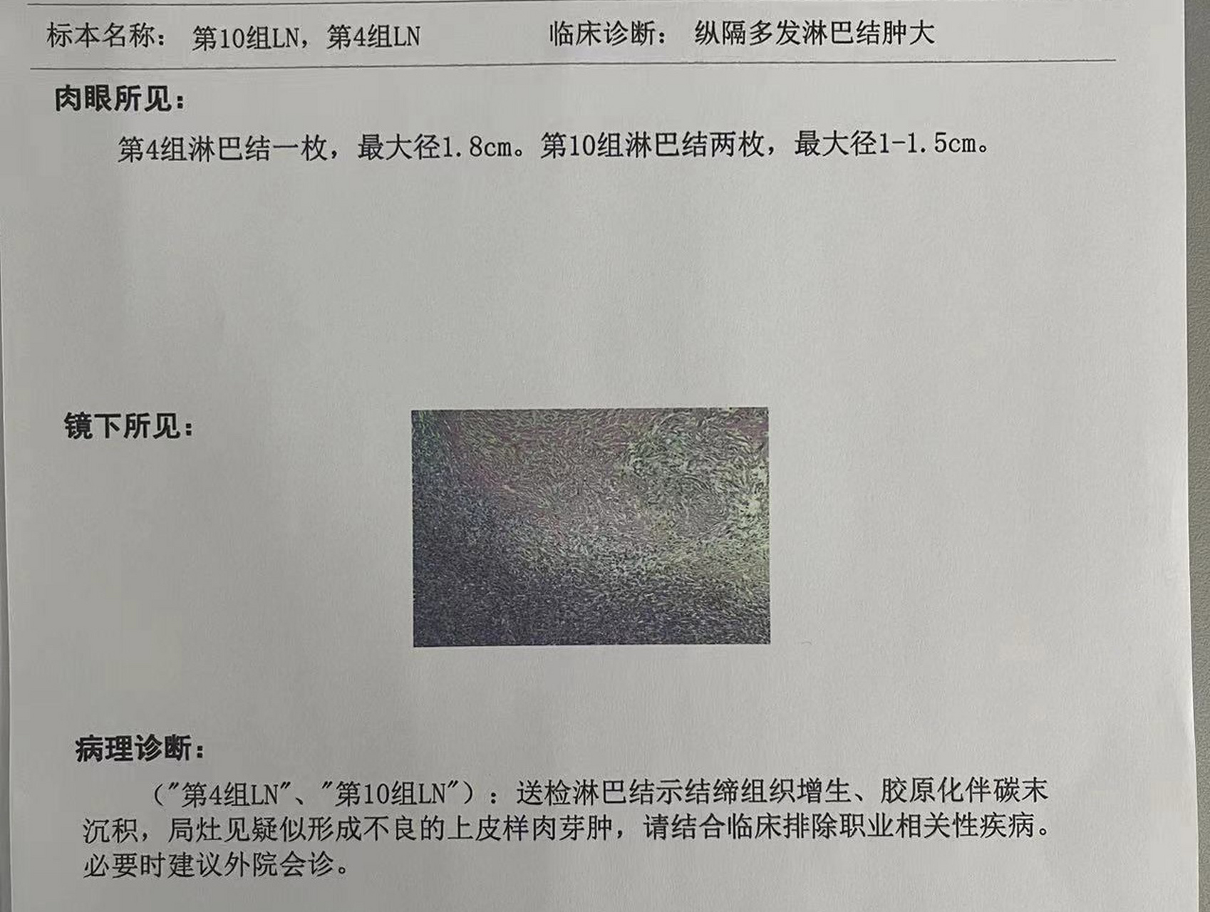 纵隔多发淋巴结肿大,肺结节 请问有懂的94,能帮忙看一下吗
