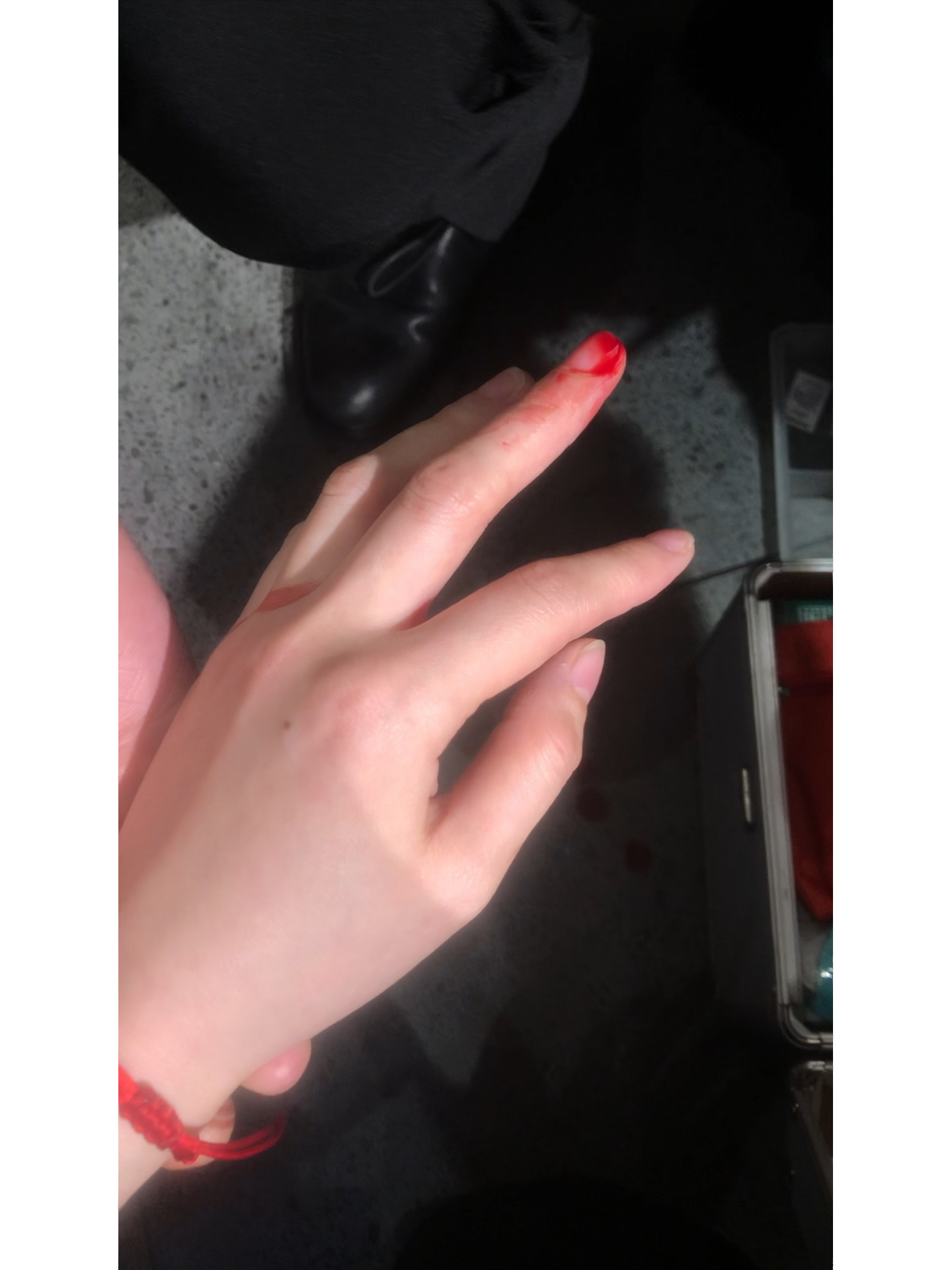 手指受伤 你们都是怎么洗澡的