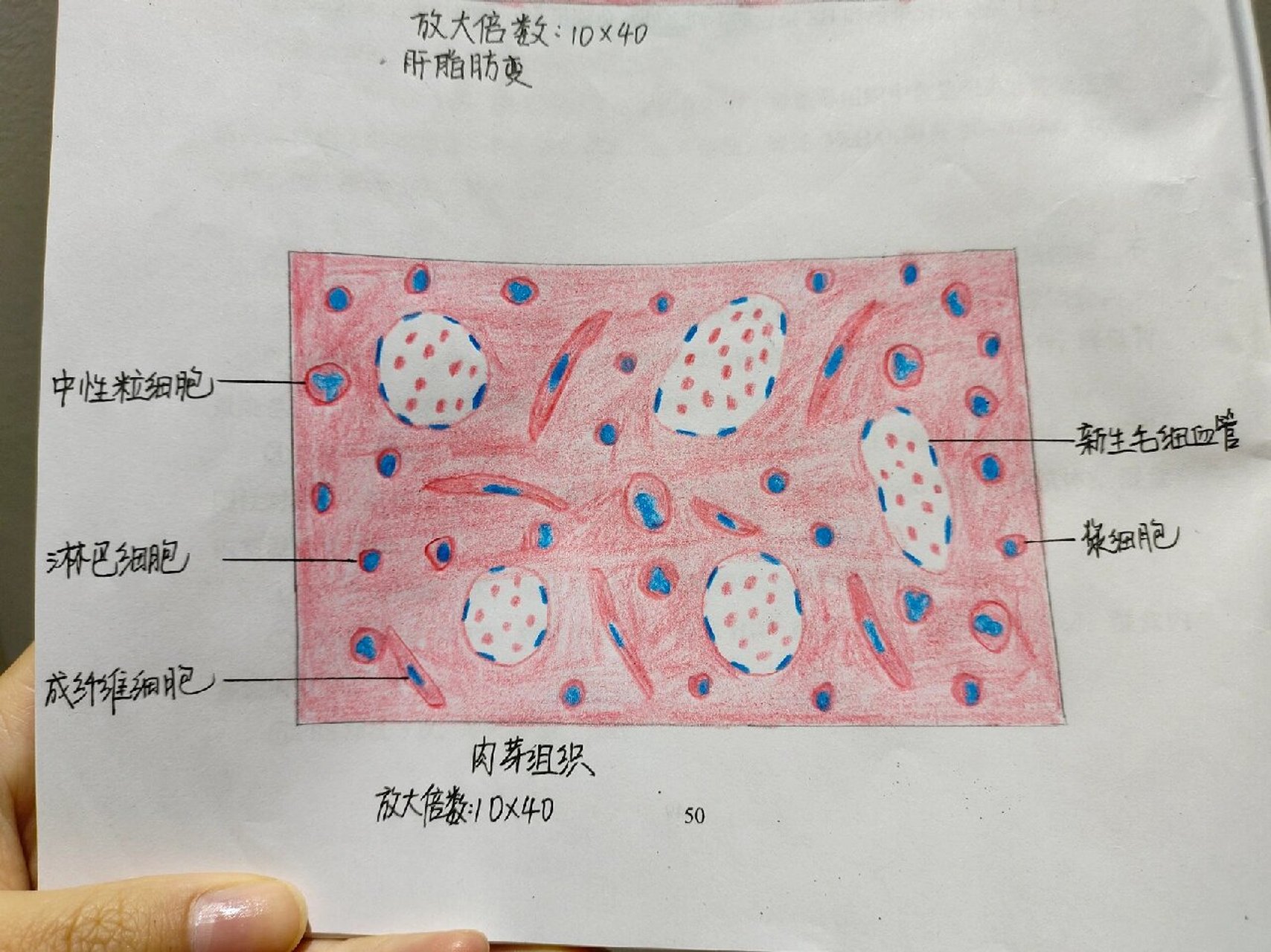 病理学 肝脂肪样变 肉芽组织 红蓝铅笔画图