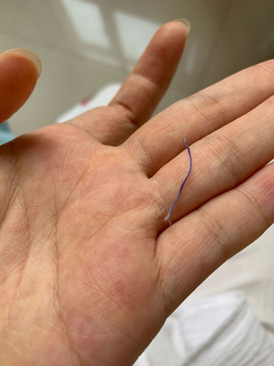顺产缝合线,这是什么线? 可吸收线是这样的吗?我的天?