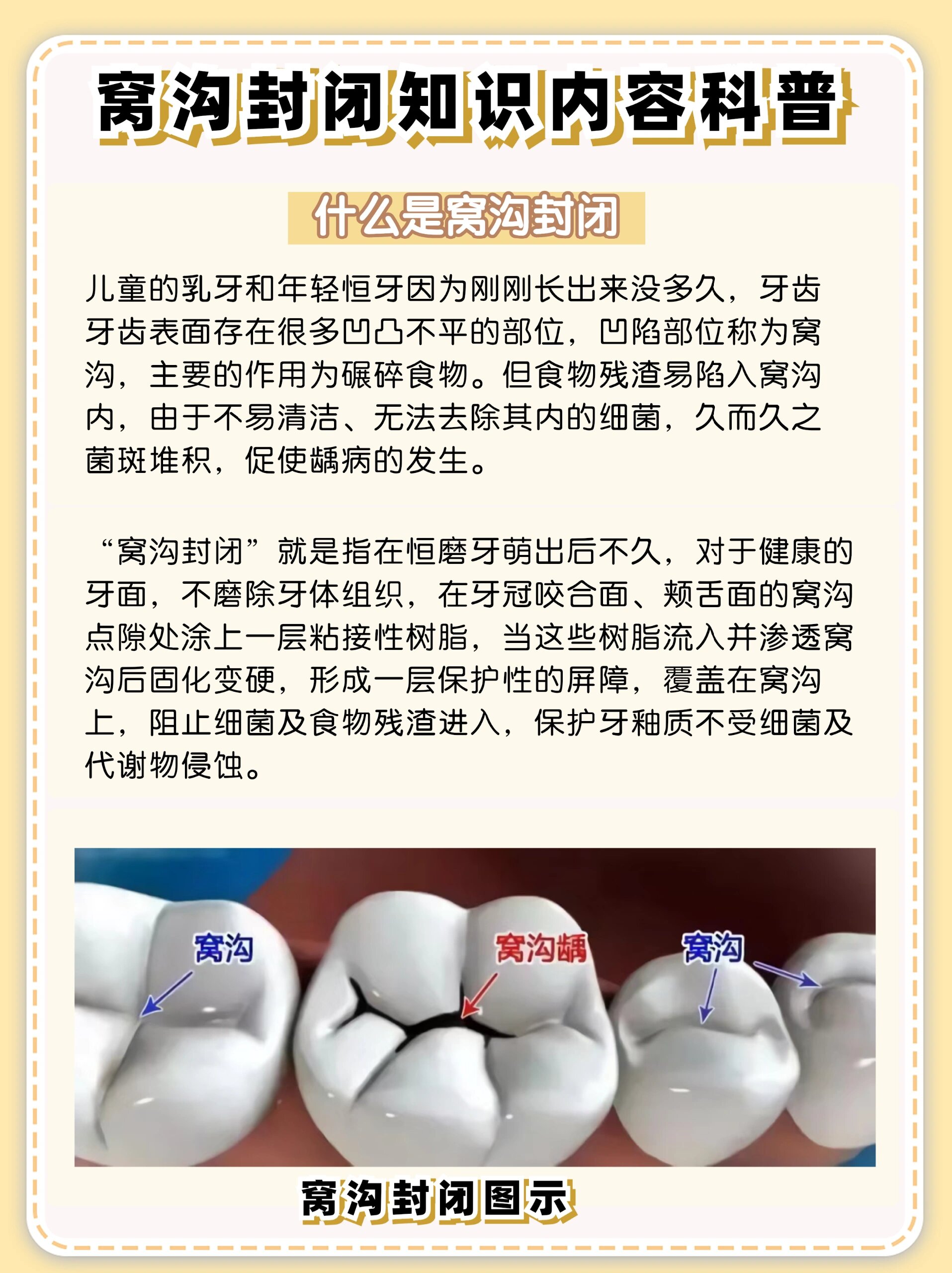 恒牙和乳牙区别图图片