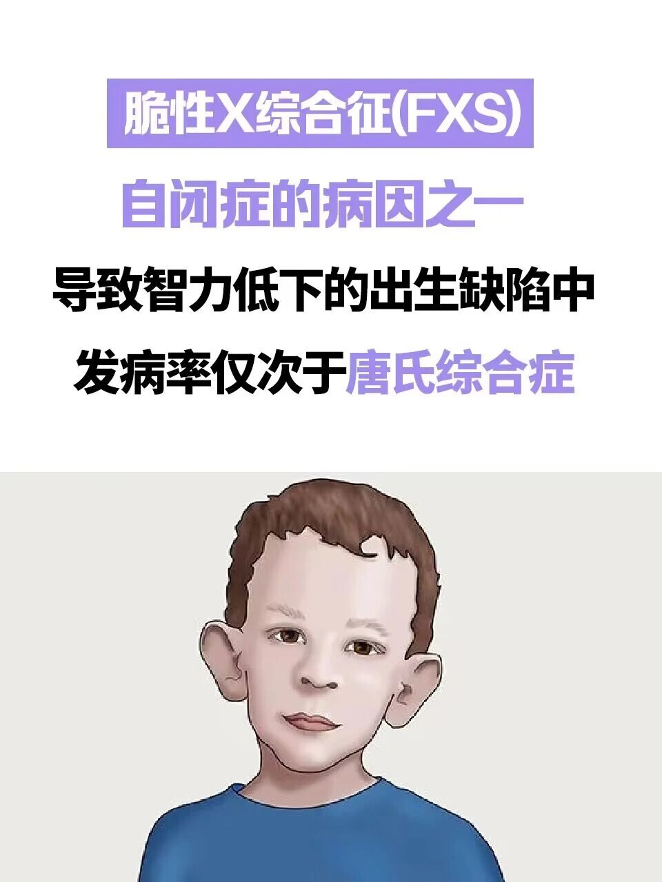 性反转综合征图片