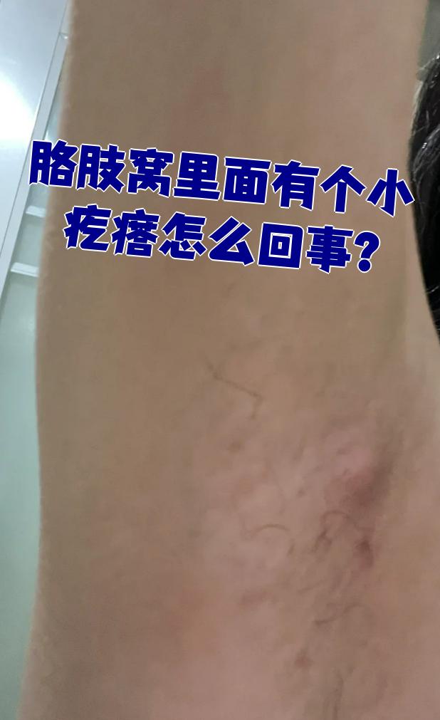 胳肢窝里面有个小疙瘩怎么回事?