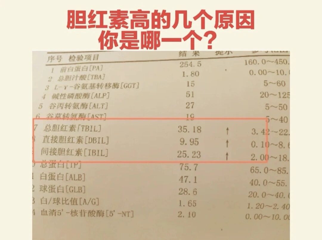 1,总胆,直接胆红素升高,而间接胆红素正常,这种情况最常见的是梗仔栽