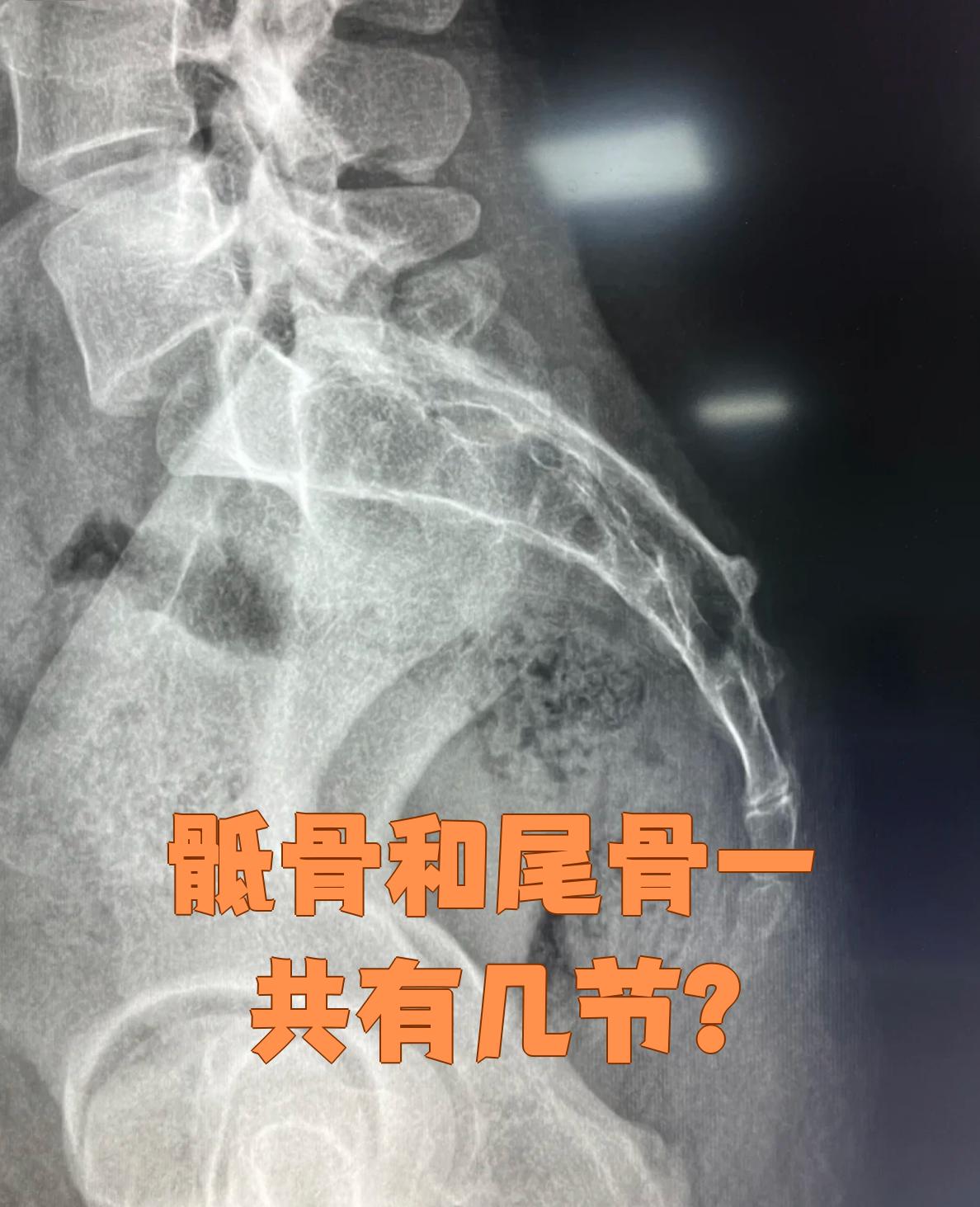 骶骨和尾骨加起来通常有8