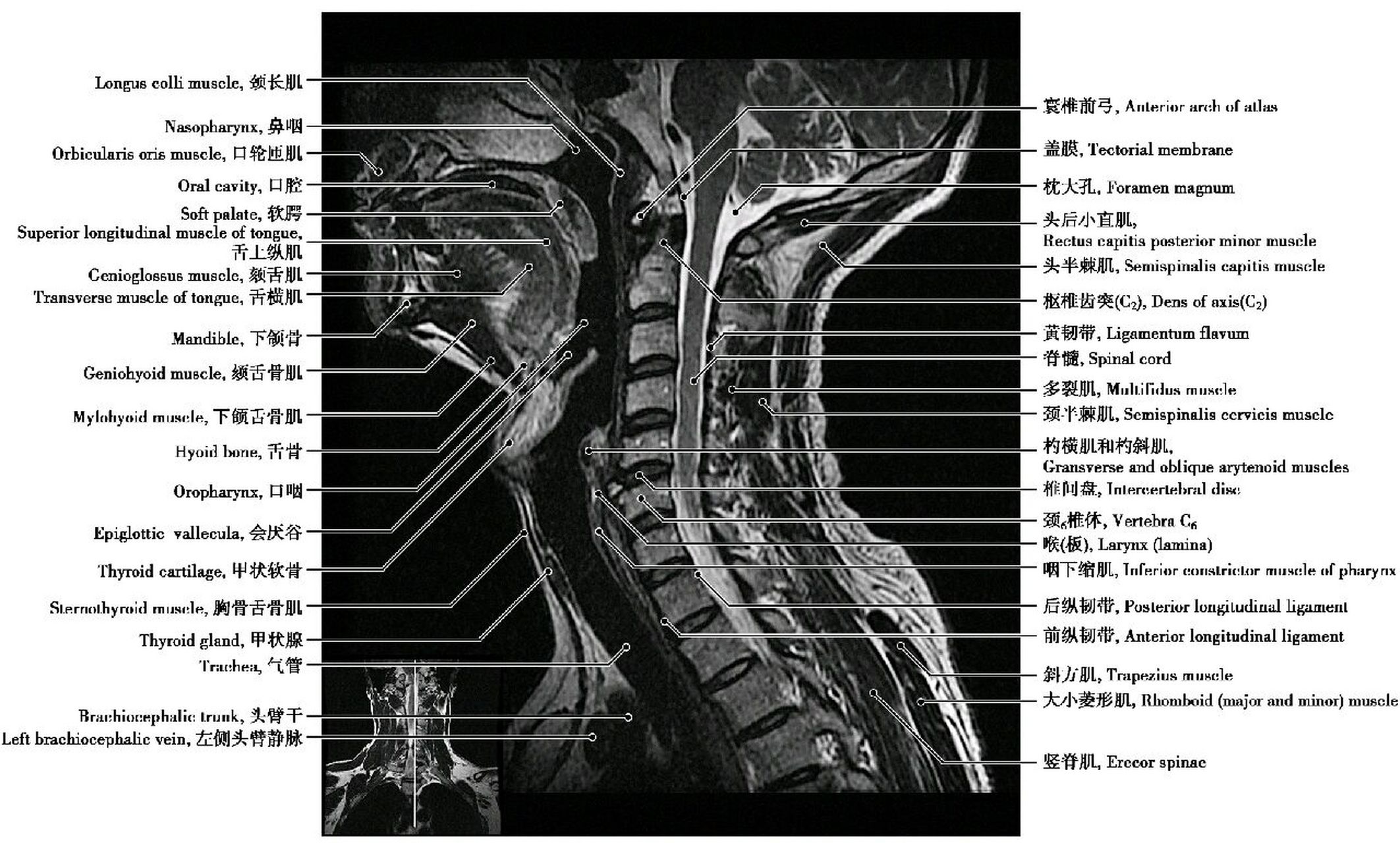 颈椎x解剖图片大全图片