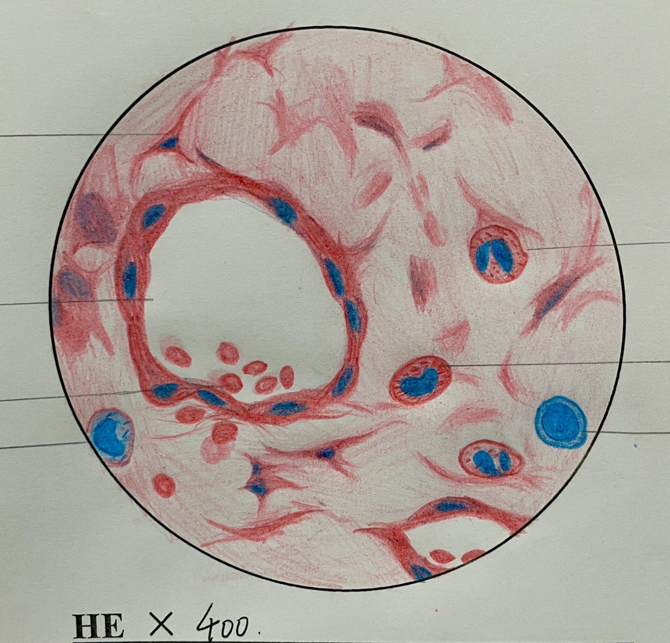 肉芽组织红蓝铅笔图片