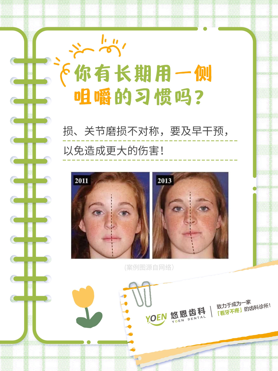 长时间使用固定一侧咀嚼,会让那侧的肌肉得到锻炼变得丰满,另一侧