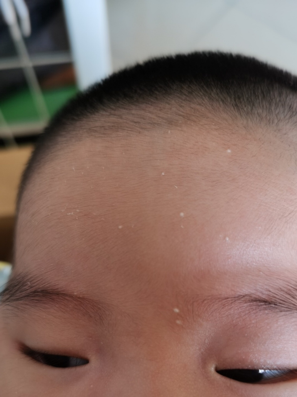 一个多月的宝宝脸上长这种白色的点点是什么,像粉刺,又没有什么办法