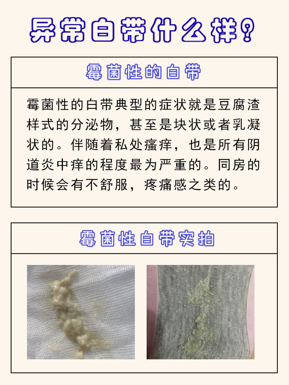 白带干了的照片对比图片