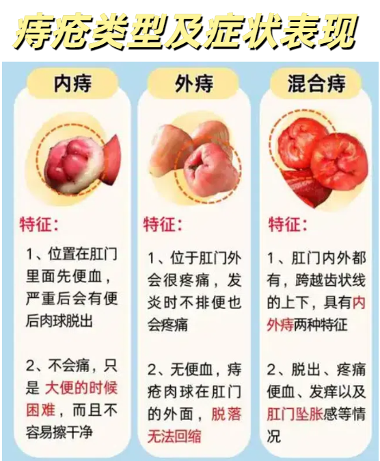 它主要发生在肛门右前,右后和左侧