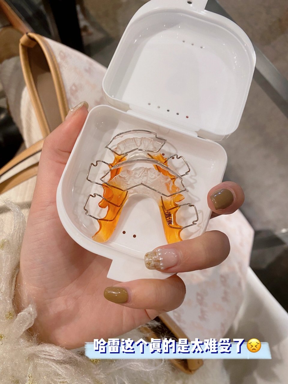 比牙套更难受的是保持器呀 两款保持器对比 牙齿矫正一年半 以为可以