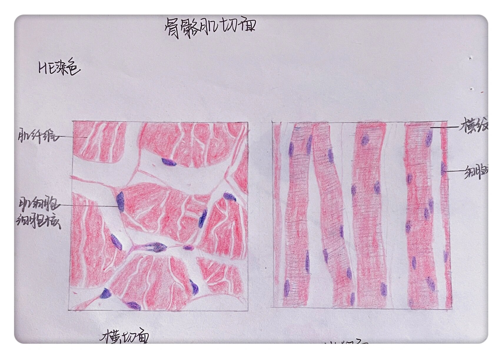 骨骼肌横纵切面