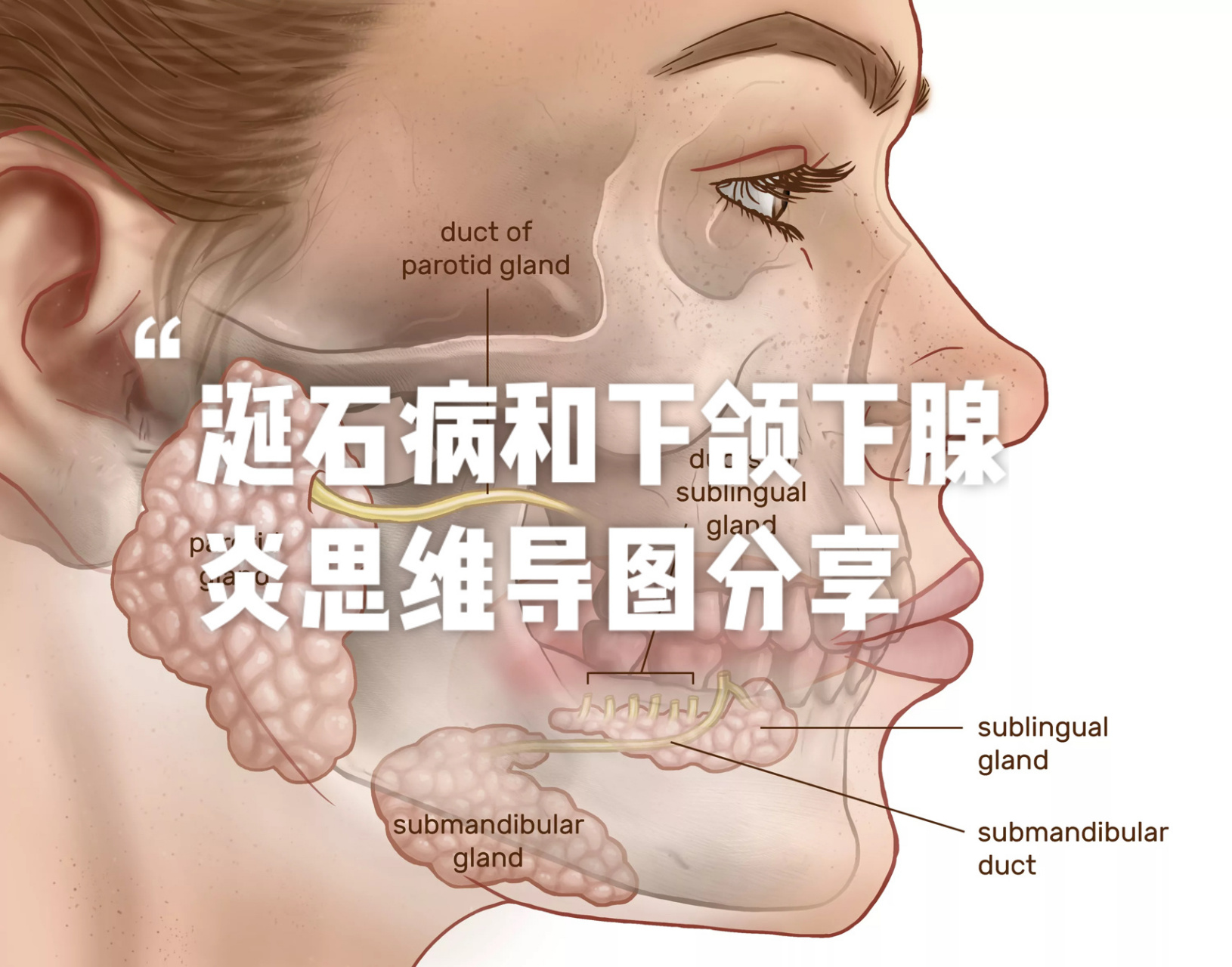 口腔外科:涎石病和下颌下腺炎思维导图分享 自己整理哒,仅供参考