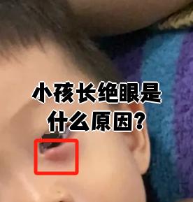 小孩长绝眼是什么原因?