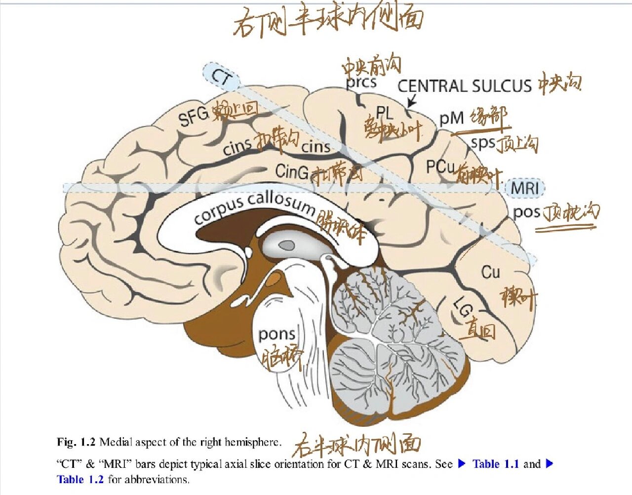 脑的解剖