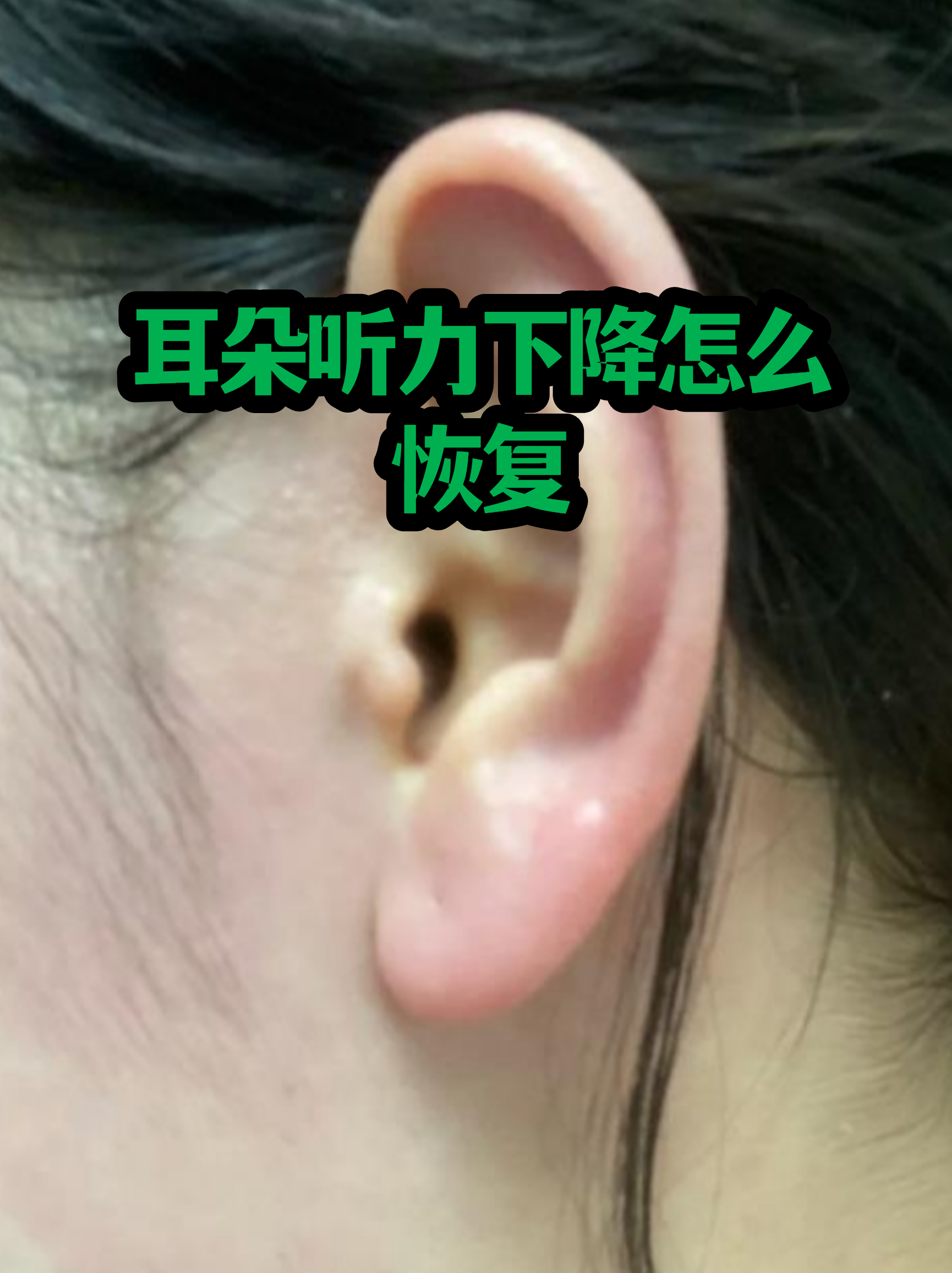 关于东直门医院检查陪护加挂号缓解就医焦虑的信息