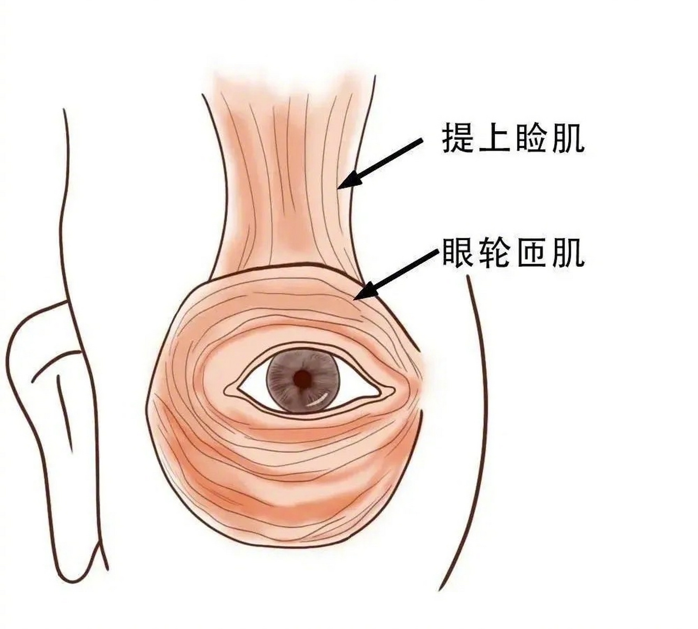 上下眼睑是闭合在一起的,睑裂处于消失状态