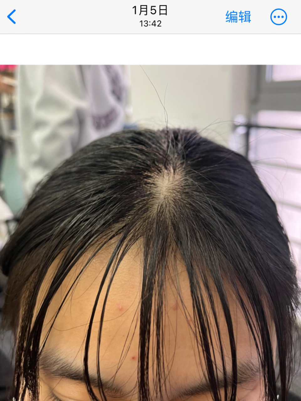 有没有跟我一样一天不洗头发就油的姐妹,早上洗完头,出去半天刘海就油